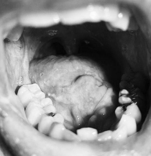 Photograph of mouth